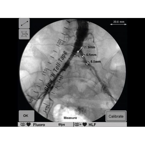 Рентген аппарат GE OEC 9900 Elite