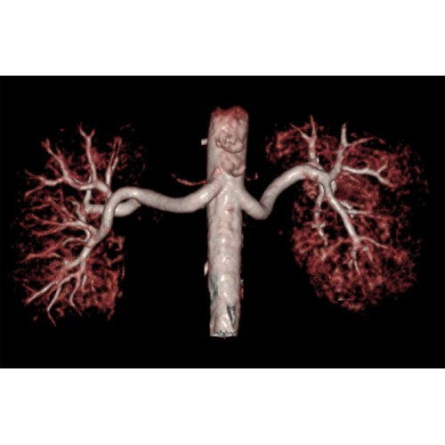 МРТ аппарат GE SIGNA Creator 1.5T