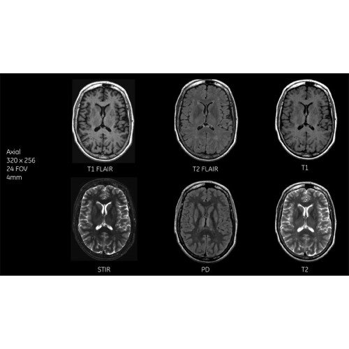 МРТ аппарат GE SIGNA Pioneer 3.0T